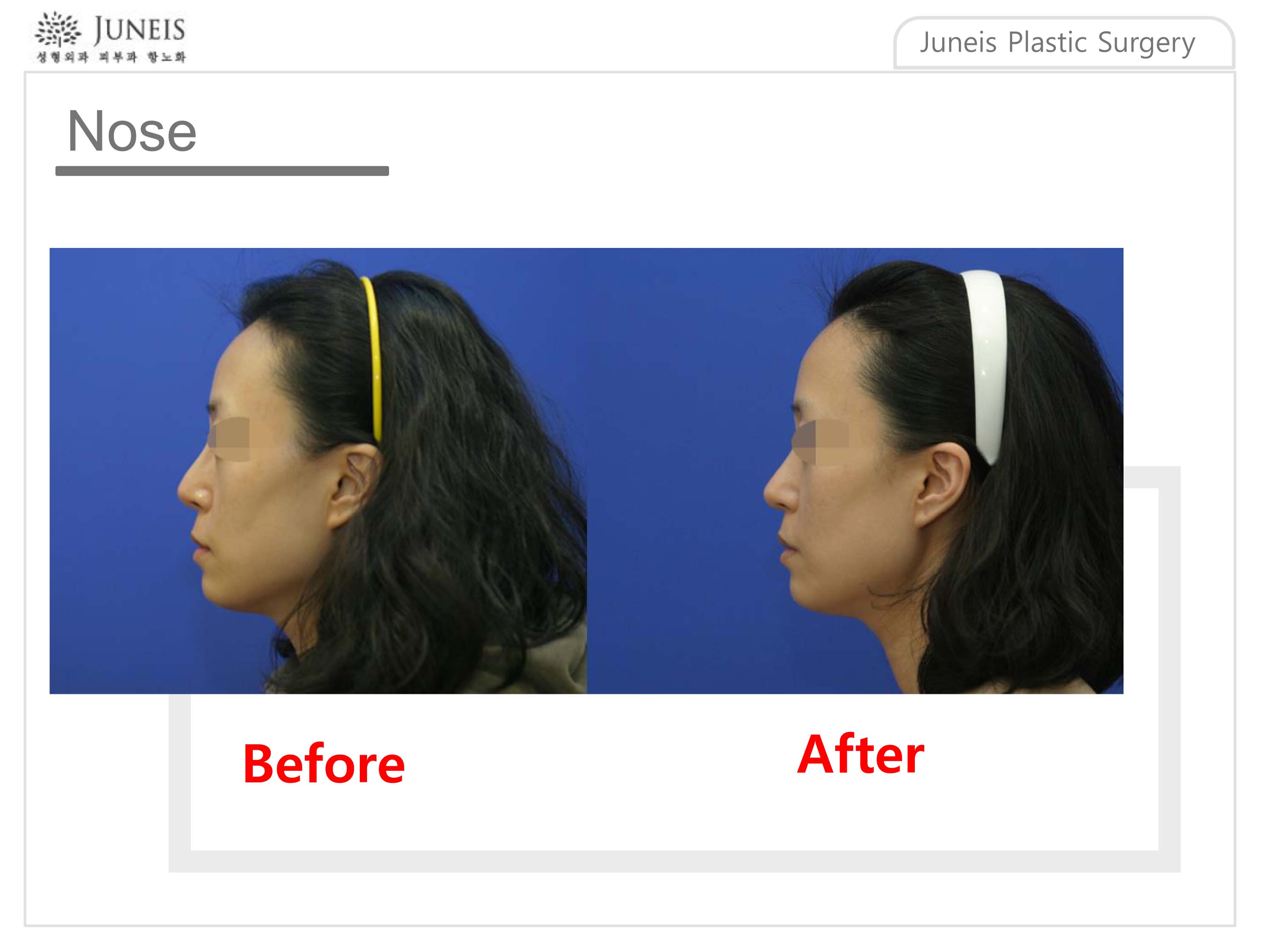 before-after-1